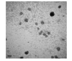 透明质酸脂质体的TEM图像 透明质酸脂质体的TEM图像