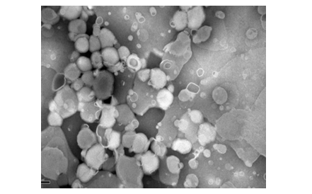 雷公藤红素醇质体透射电镜图